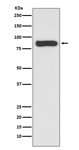 STAT4 Ab