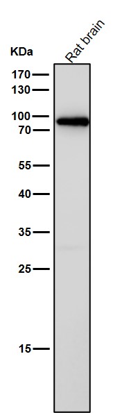 STAT5B Ab