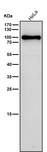 STAT5B Ab