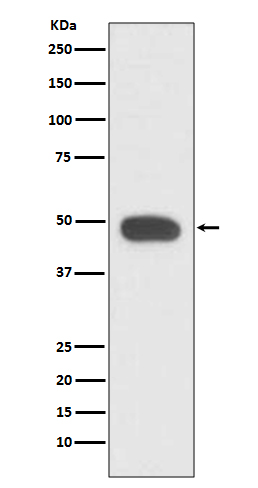 PAX6 Ab