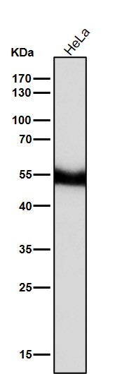 PAX6 Ab