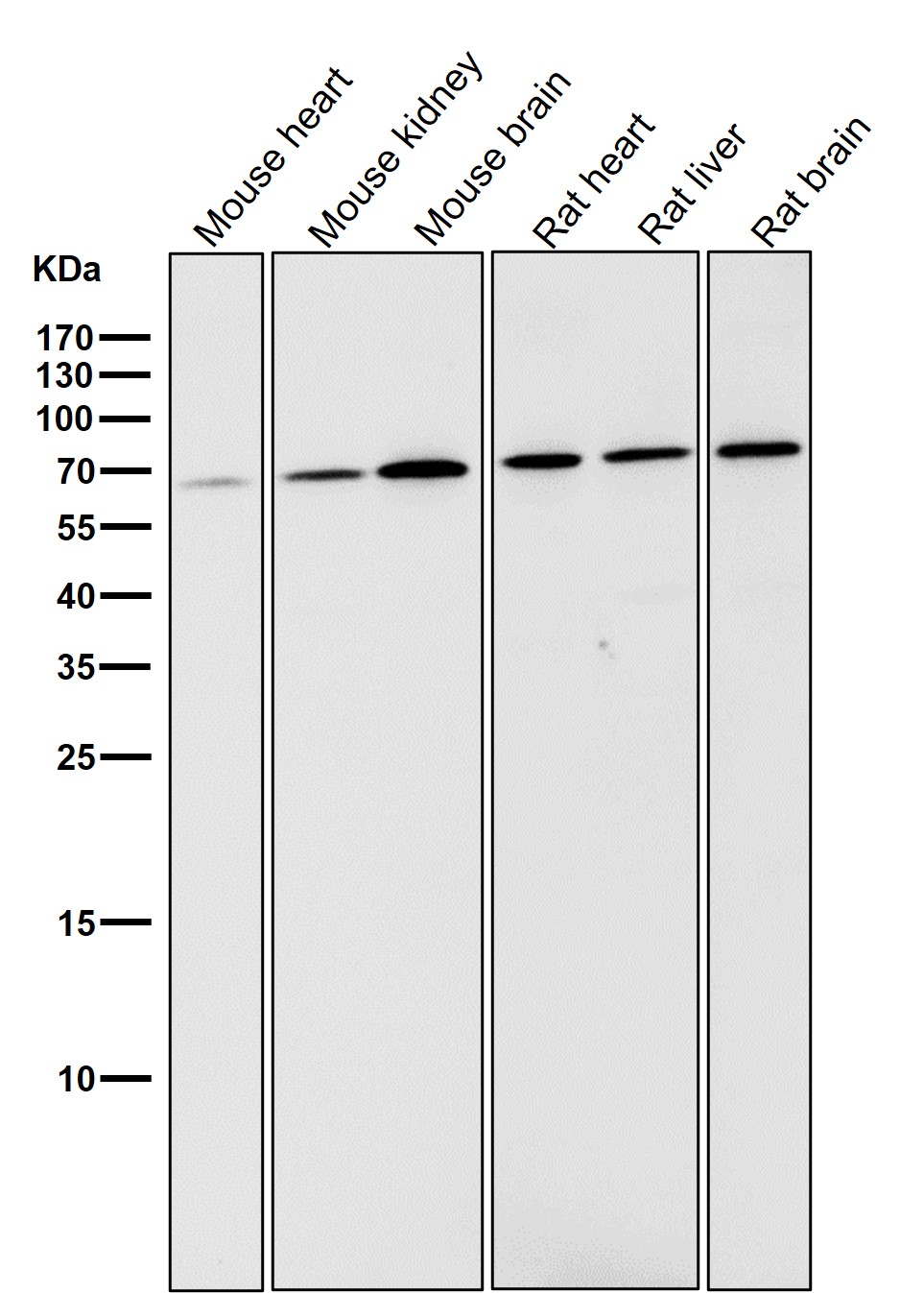 p-AMPK alpha 2 (S345) Ab