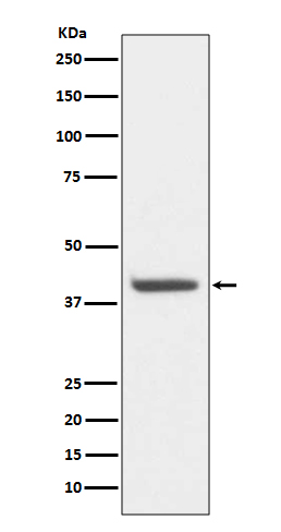 HDAC8 Ab