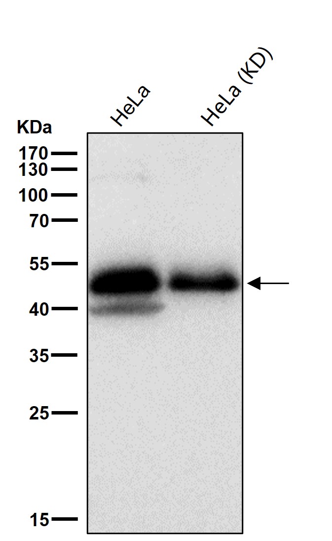 PAX6 Ab