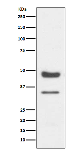 PAX6 Ab