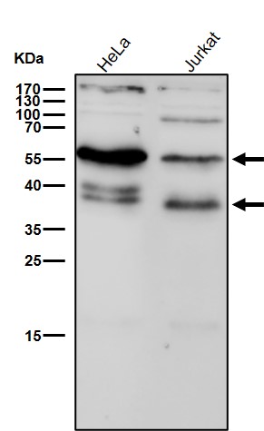 PAX6 Ab