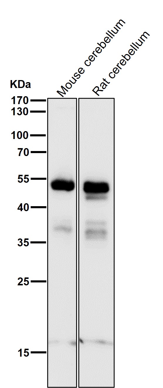 PAX6 Ab