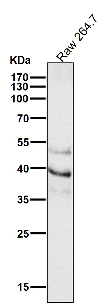 PAX6 Ab