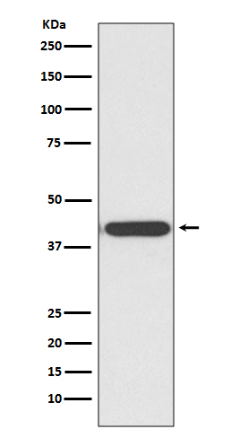 HDAC8 Ab