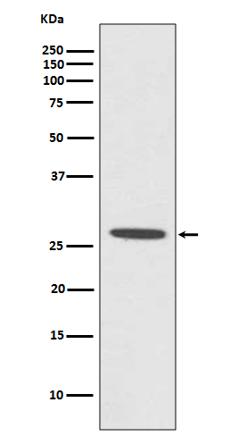 CDCA3 Ab