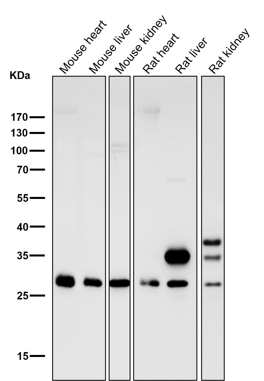 CDCA3 Ab