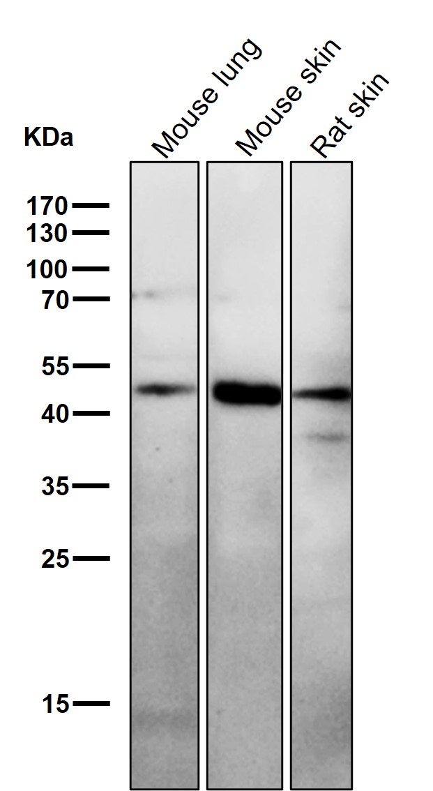 Serpin H1 Ab