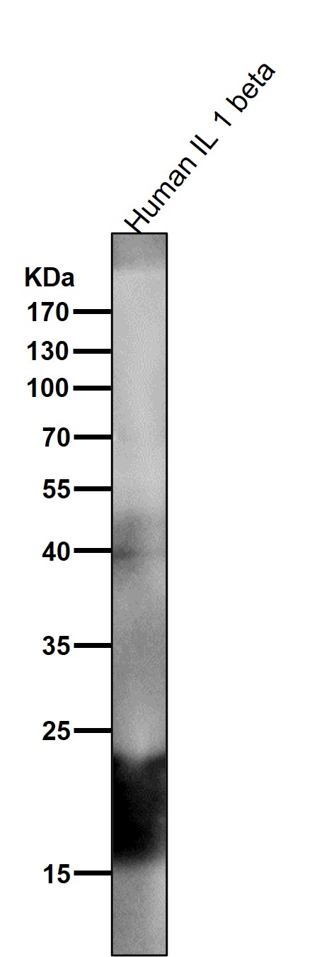 IL 1 beta Ab
