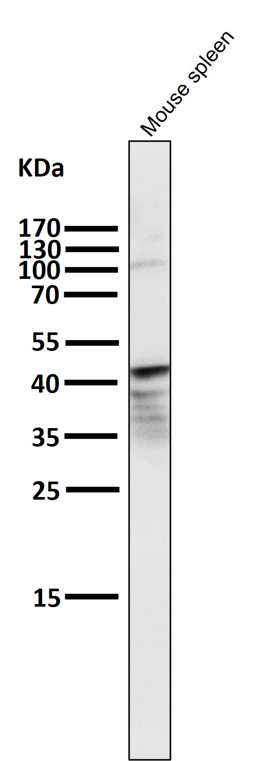 PAX5 Ab