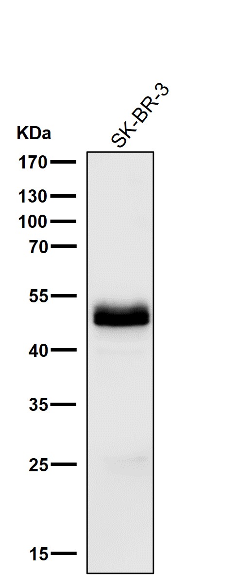 PAX8 Ab