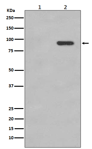 p-beta Catenin (S33/S37) Ab