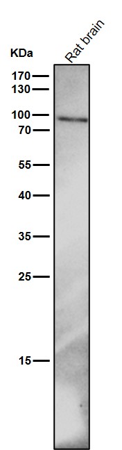 p-beta Catenin (S33/S37) Ab