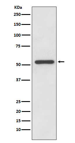 MMP13 Ab