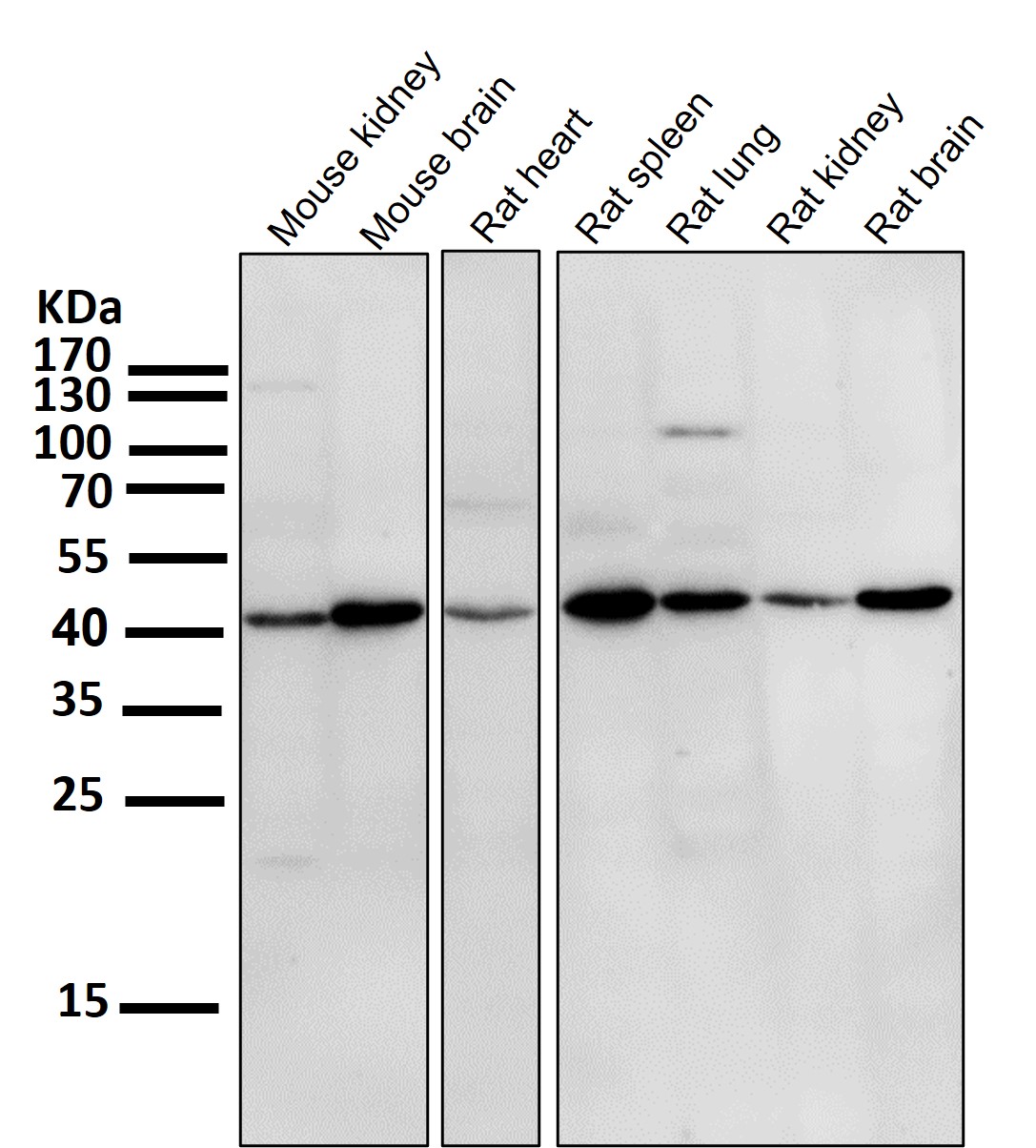 PD L1 Ab