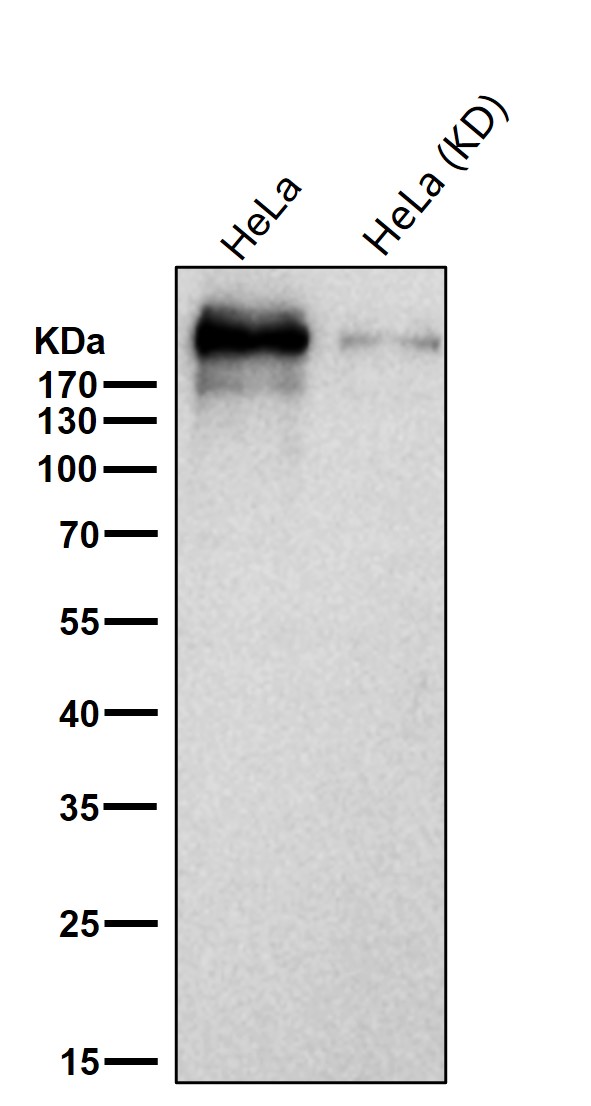 ARID1A Ab