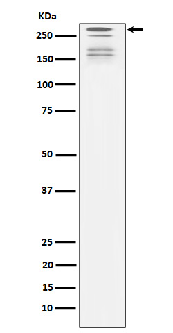 ARID1A Ab