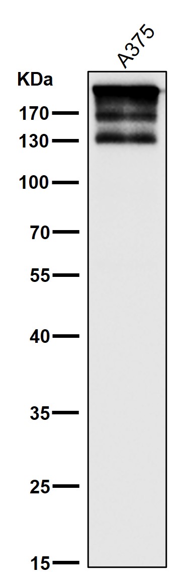 ARID1A Ab