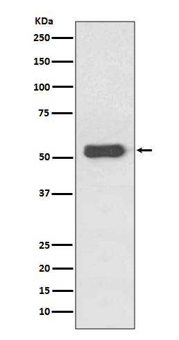 Estrogen receptor beta Ab