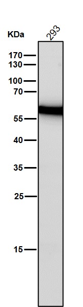 Estrogen receptor beta Ab