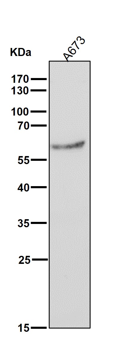 Estrogen receptor beta Ab