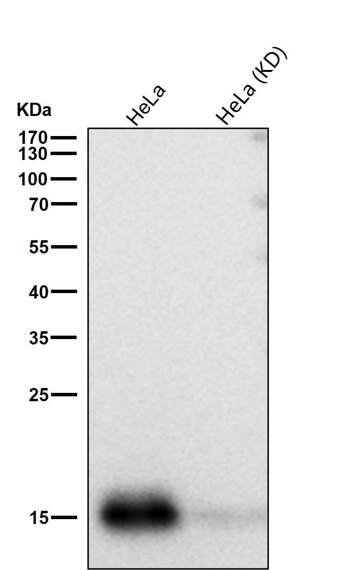 Cystatin C Ab