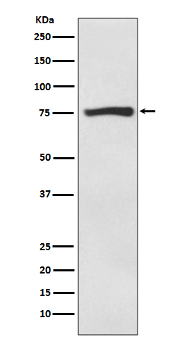 ACSS2 Ab