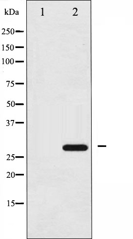 p-14-3-3 zeta/delta (S58) Ab