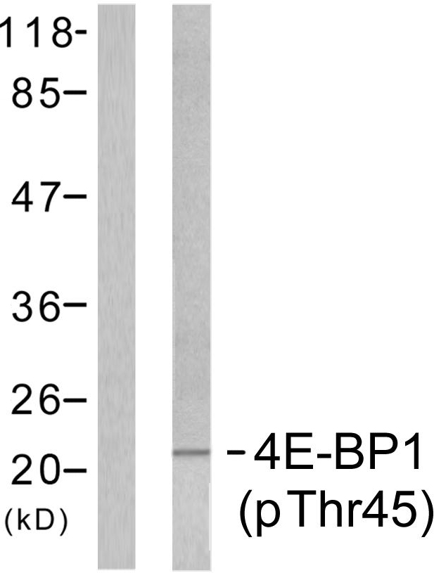 p-4E BP1 (T45) Ab