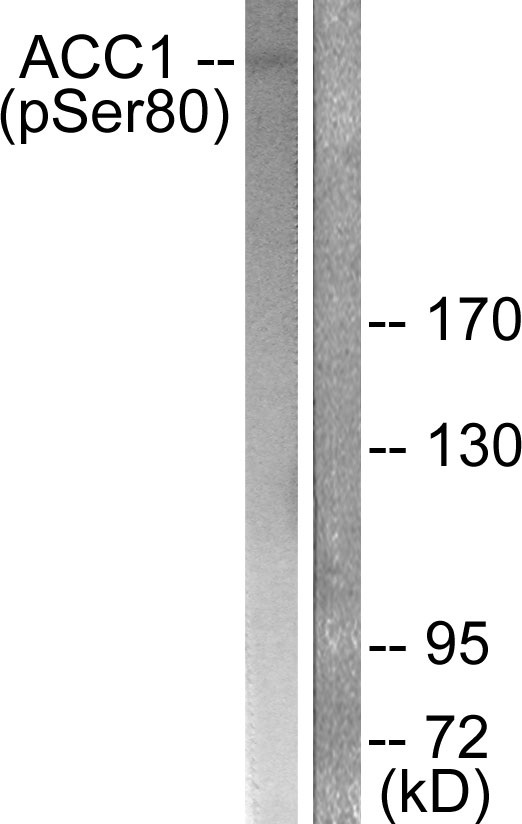 p-Acetyl CoA carboxylase 1 (S80) Ab