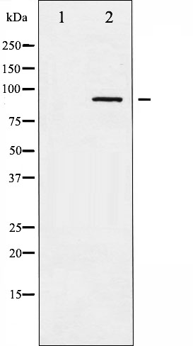 p-alpha/beta Adducin (S726) Ab