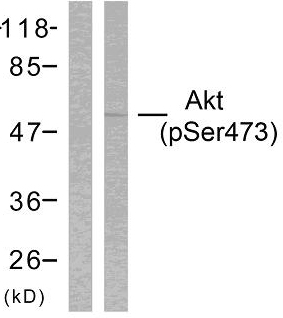 p-AKT (S473) Ab