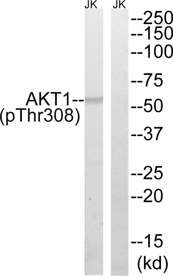 p-AKT1 (T308) Ab