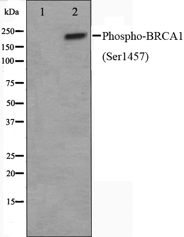 p-BRCA1 (S1457) Ab