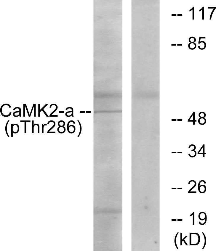 p-CaMKII alpha/delta (T286/T287) Ab