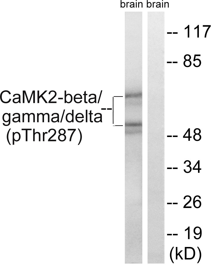 p-CaMKII beta/gamma/delta (T287) Ab