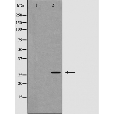 p-Caspase 1 (S376) Ab