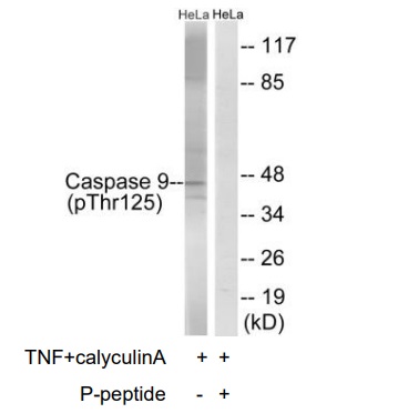 p-Caspase 9 (T125) Ab