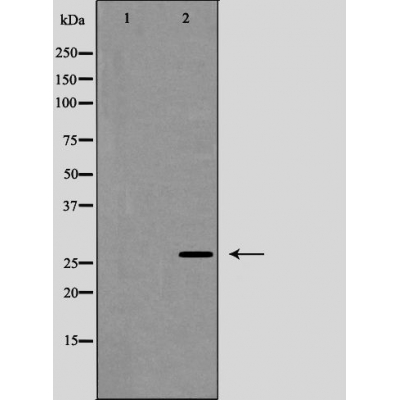 p-Caveolin 2 (Y27) Ab