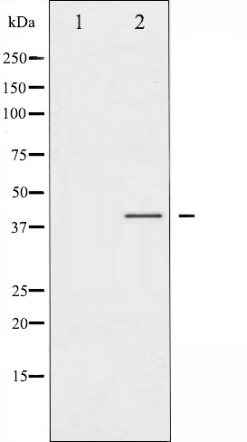 p-CCR5 (S336) Ab