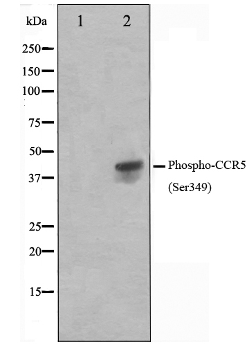 p-CCR5 (S349) Ab