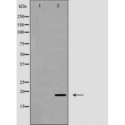 p-CD247 (Y142) Ab