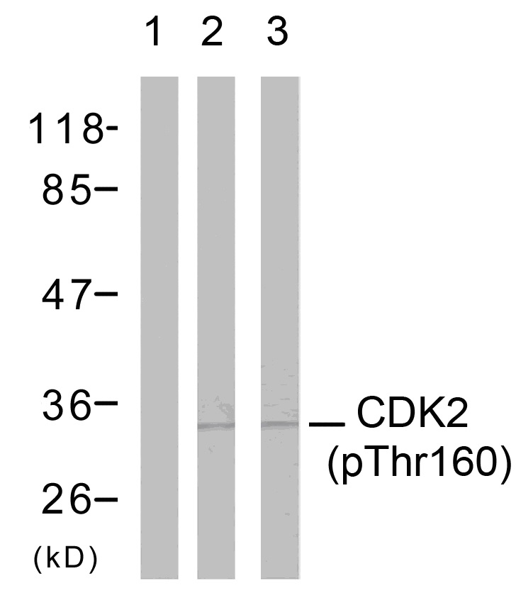 p-CDK2 (T160) Ab