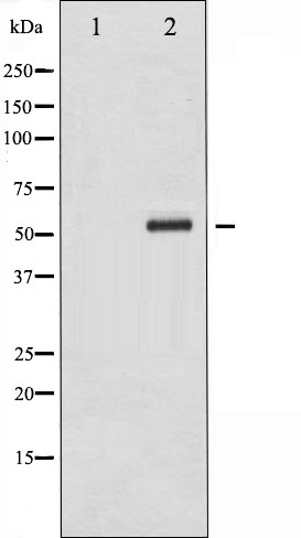 p-Chk2 (S516) Ab