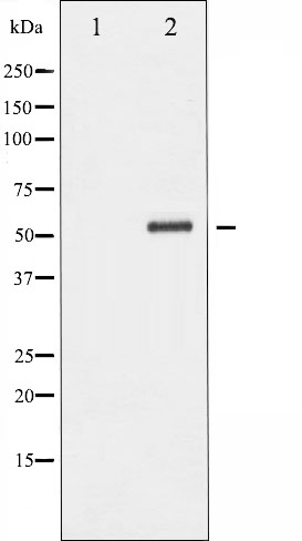 p-Chk2 (T68) Ab