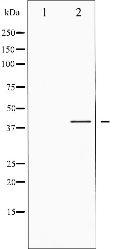 p-CREB1 (S142) Ab